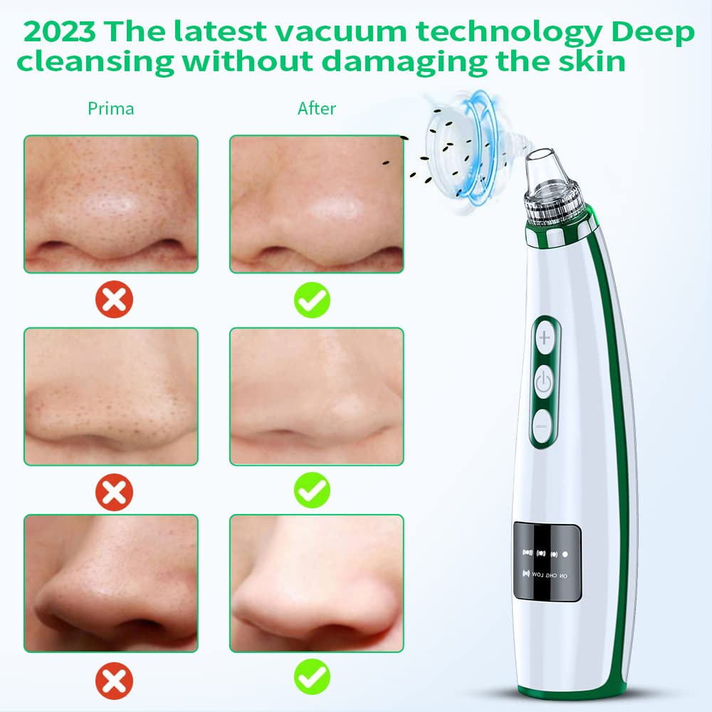 2023 Newest Blackhead Remover Pore Vacuum,Upgraded Facial Pore Cleaner,Electric Acne Comedone Whitehead Extractor Tool-5 Suction Power,5 Probes,USB Rechargeable Blackhead Vacuum Kit for Women & Men - Image 5